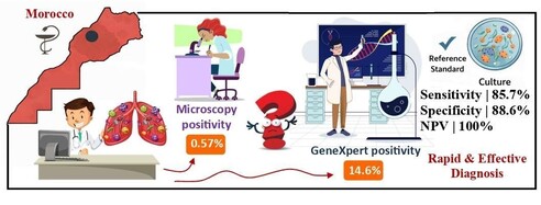 Extrapulmonary tuberculosis (EPT) is caused by Mycobacterium tuberculosis and affects sites other than the lungs, and GeneXpert MTB/RIF is a WHO-recommended automated PCR assay for rapid detection of the Mycobacterium tuberculosis complex and rifampicin resistance. In a 36-month retrospective study including 155 EPT cases in Morocco, GeneXpert showed higher positivity than microscopy (14.61% vs 0.57%) and good performance compared to culture, with a sensitivity of 85.71%, specificity of 88.63%, and negative predictive value of 100%, supporting its use as a rapid and effective diagnostic tool for EPT.